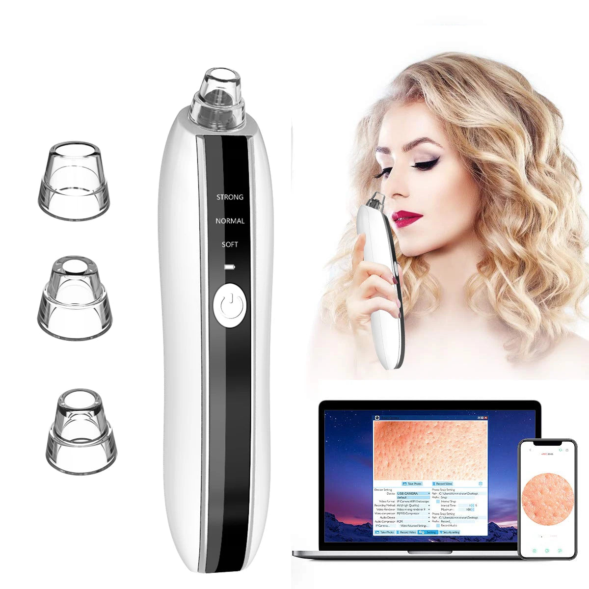 Acne Pimple Extractor Vacuum