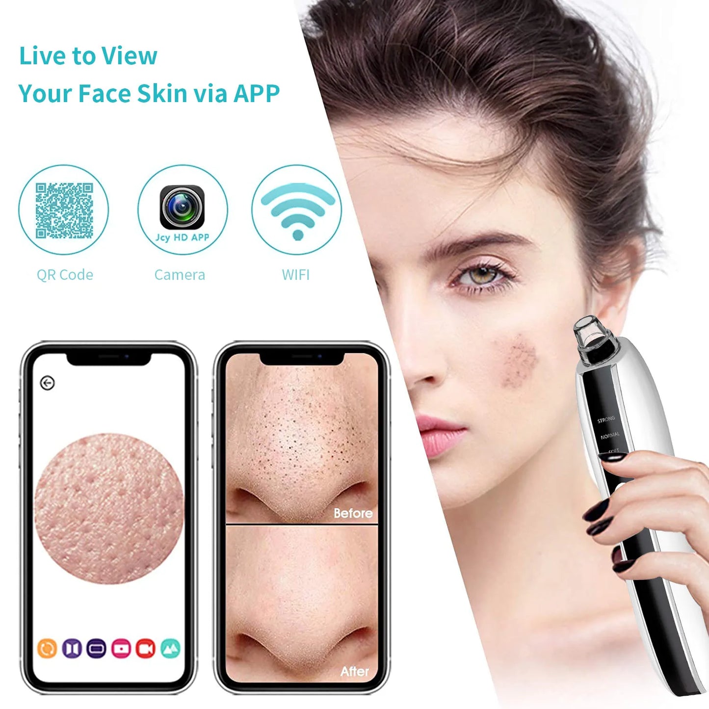 Acne Pimple Extractor Vacuum