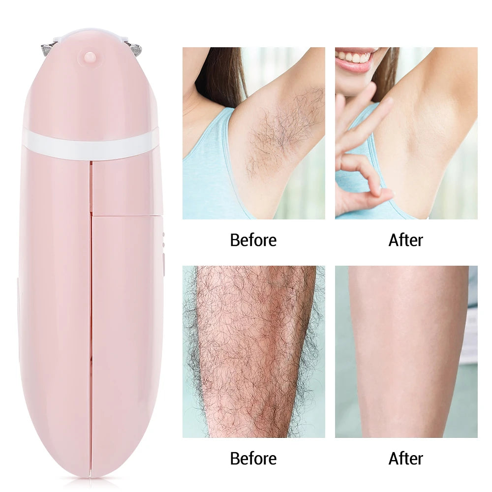 Portable Electric Hair Removal Epilator – Painless Face & Body Trimmer